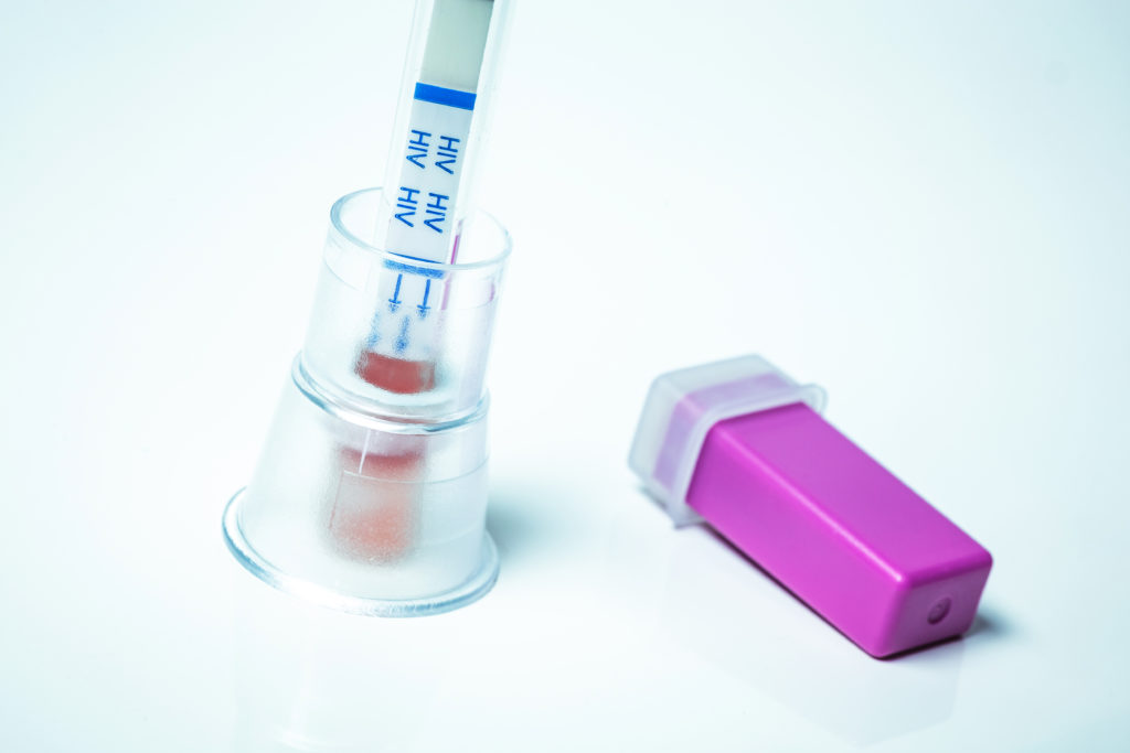 home HIV test