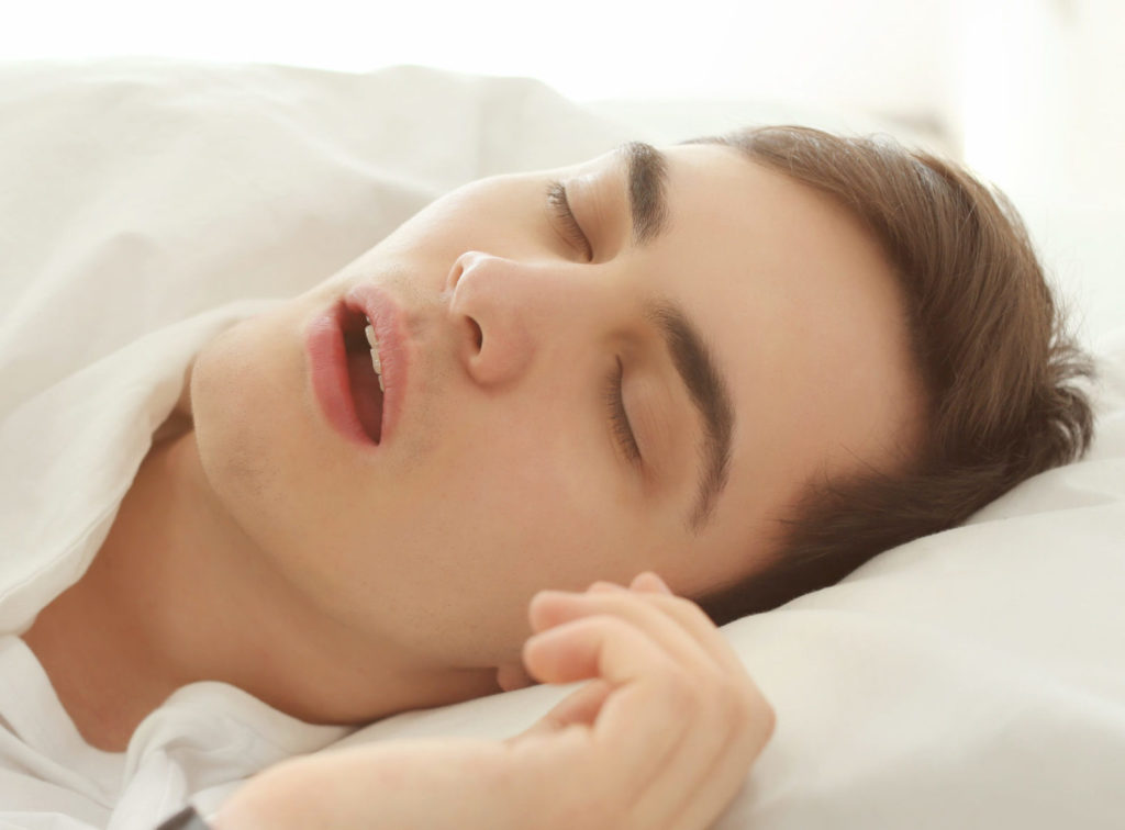 sleep apnea