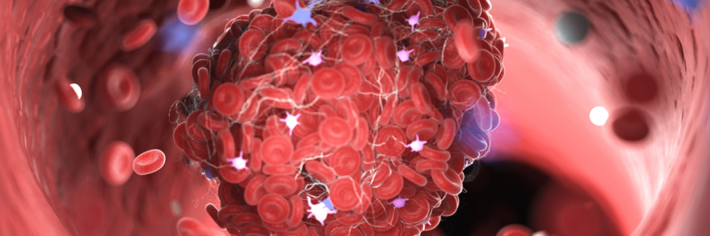 Blood clotting