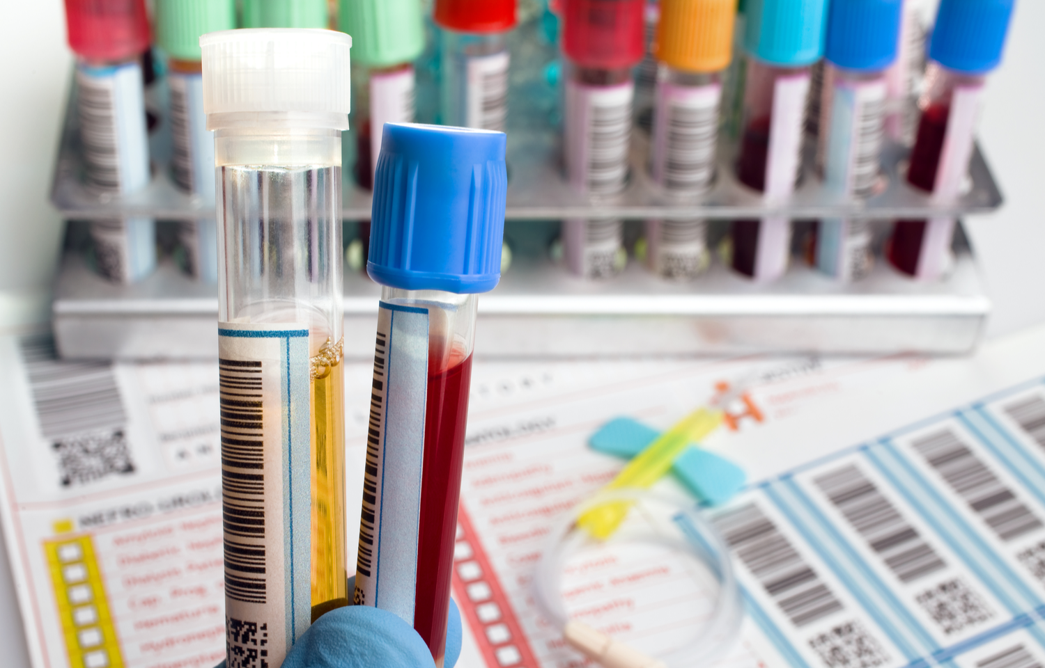 Blood samples with barcoded labels